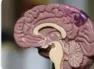 Brain gym